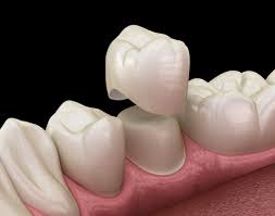 South Barrington IL Dentist