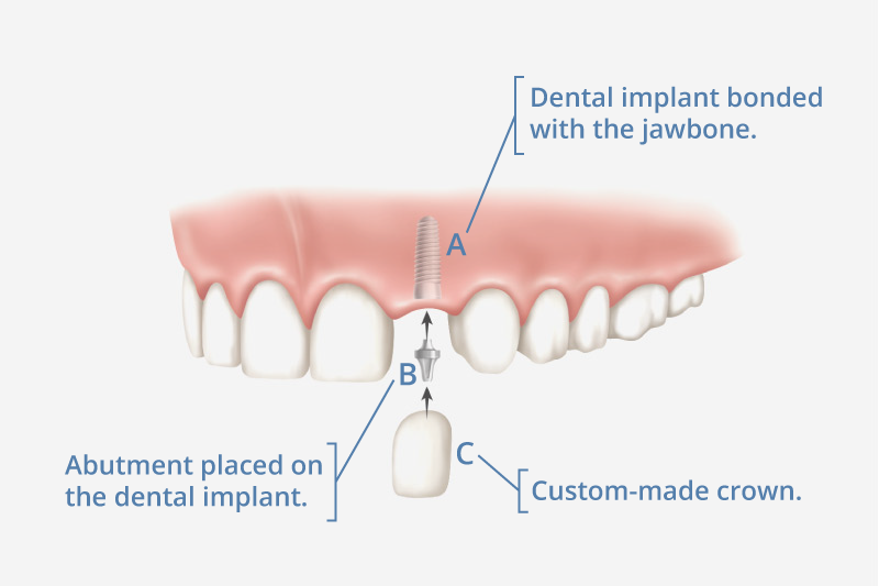 South Barrington IL Dentist